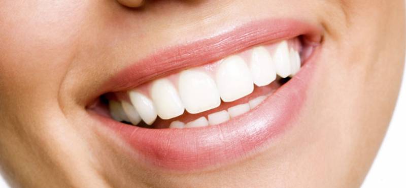 Différents types de facettes dentaires-Dr TOURROLIER Didier -Marseille